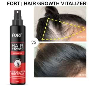 FORT Minoxidil Hair Growth Spray – Hair Tonic for Hair Care and Hair Growth