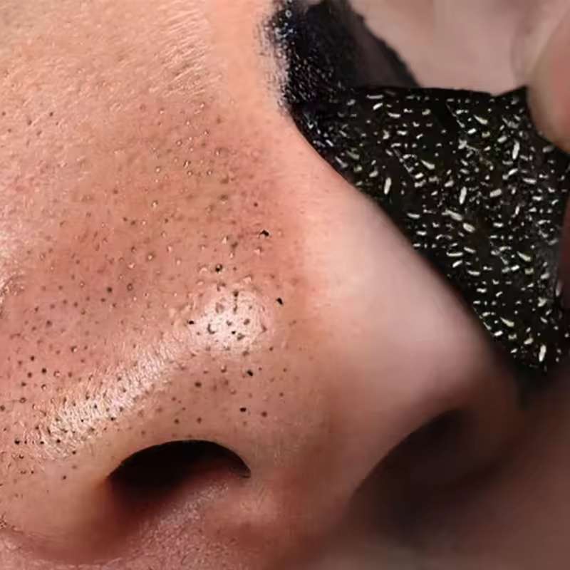Nose Blackhead Remover Strips